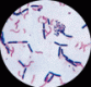 Gram-staining