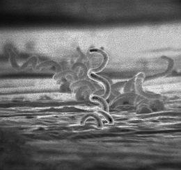 http://hu.wikipedia.org/wiki/Treponema_pallidum