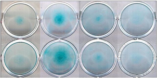 http://en.wikipedia.org/wiki/File:Alcian_stain_micromass.jpg