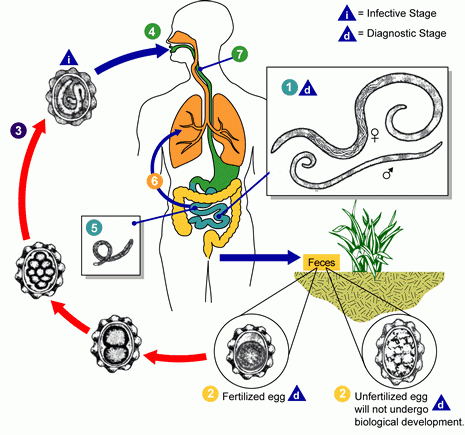 Ascaris lumbricoides (Orsógiliszta)