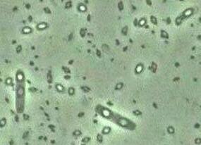 Bacillus thuringiensis