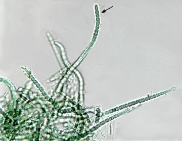 Calothrix sp.