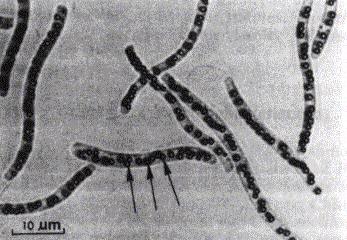 Thiospirillum jenense