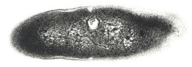 Methanobacterium sp.