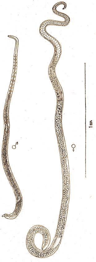 Trichinella spiralis