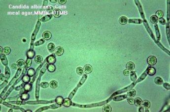 http://www.medicinfo.hu/images/candidak.jpg