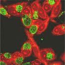 http://www.bioquicknews.com/node/45