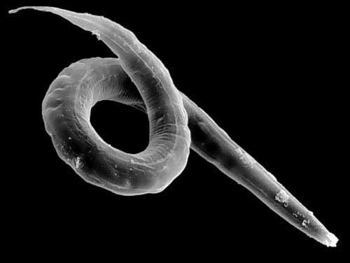 http://www.bu.edu/gk12/eric/nematode.jpg