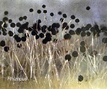 Rhizopus