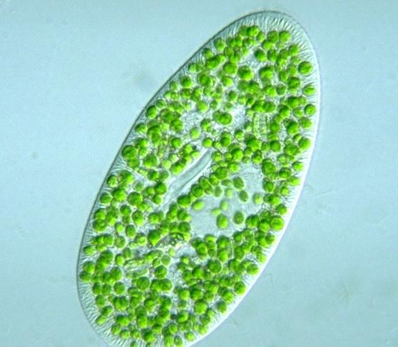 http://shannenpscientist5.blogspot.com/2008/02/paramecium-bursaria.html