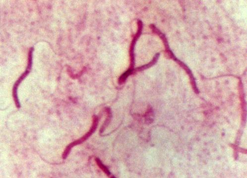 Spirillum volutans