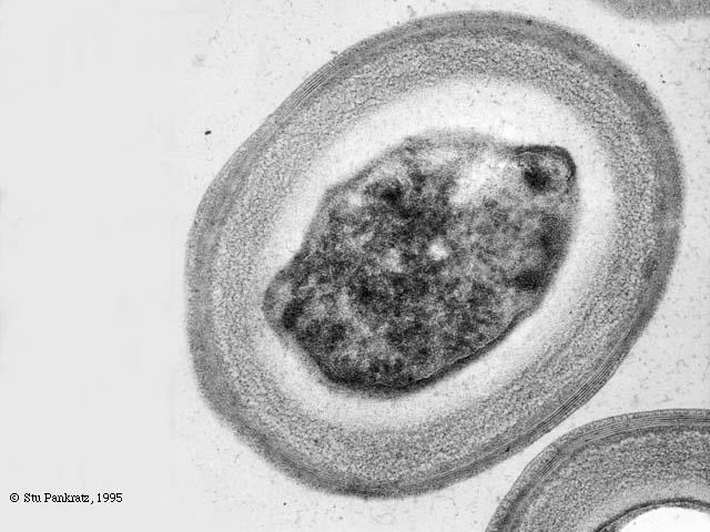 Bacillus stearothermophilus