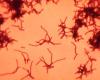 Actinomyces israelii