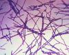 Bacillus anthracis