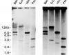 Southern blot