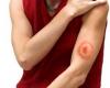 http://egeszseg.origo.hu/cikk/0921/217797/20090520_lymekor_kullancs_kullancscsip