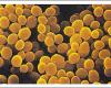 Micrococcus sp.