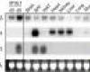 Northern blot